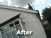 A fascia after the Aqua Clean treatment